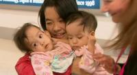 Bhutanese conjoined twins separated at Australian hospital
