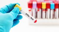 One million STDs diagnosed every day: WHO