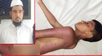 Madrasa boy beaten with iron rod by teacher for ‘stealing money’