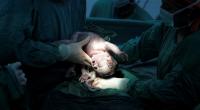 Baby gut study finds bacteria different after C-section births