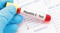 Way forward to eliminate hepatitis C by 2030