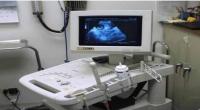 Brahmanbaria bans ultrasound to determine foetus’ sex