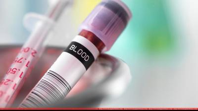 New blood test can detect eight common cancers: Study
